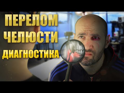 Видео: Човешка челюст на 200 000 години, открита в Израел, шокира учени - Алтернативен изглед