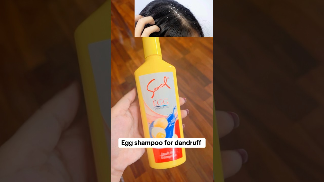 Egg shampoo for dandruff 