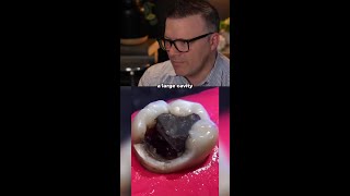 This tooth looks beyond saving, but it’s not