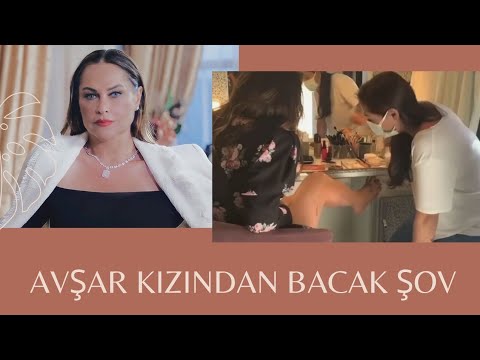 DÖVMELERİNİ KAPATTIRDI .HÜLYA AVŞAR'DAN BACAK ŞOV