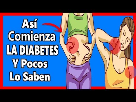 👉si-tienes-varios-síntomas-de-estos-puede-ser-inicio-de-diabetes-y-no-lo-sabes-¡cuídate!