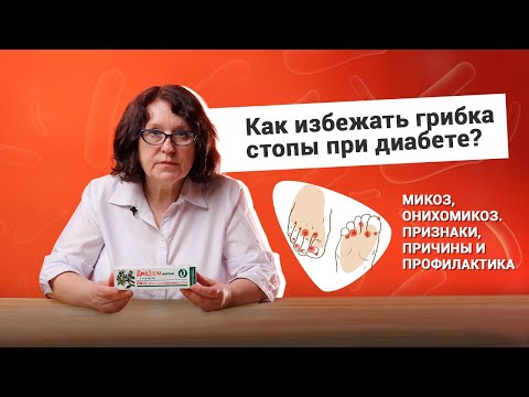 Как избежать грибка стопы при диабете? Микоз, онихомикоз. Признаки, причины и профилактика