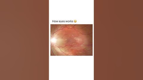 How our eyes work.. optometry 