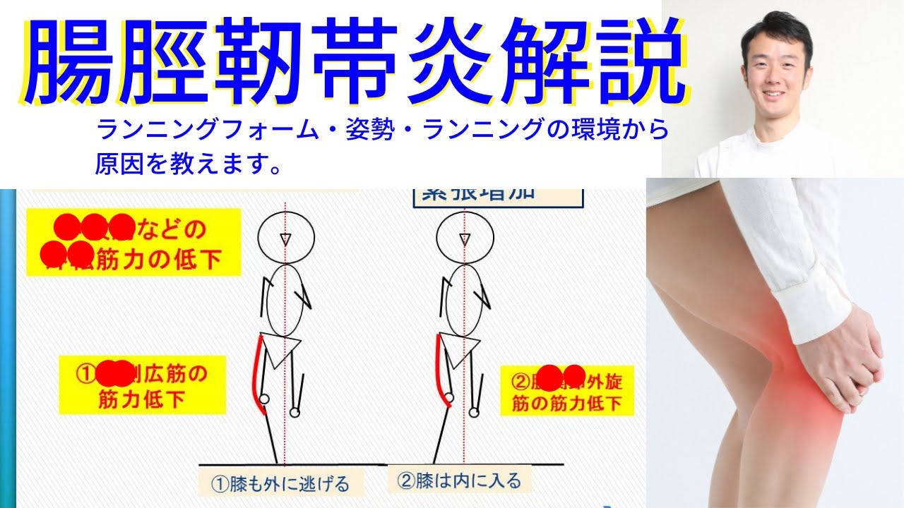 腸脛靭帯炎はなぜおこる！？姿勢とランニングフォームから解説！【FLAT柏】