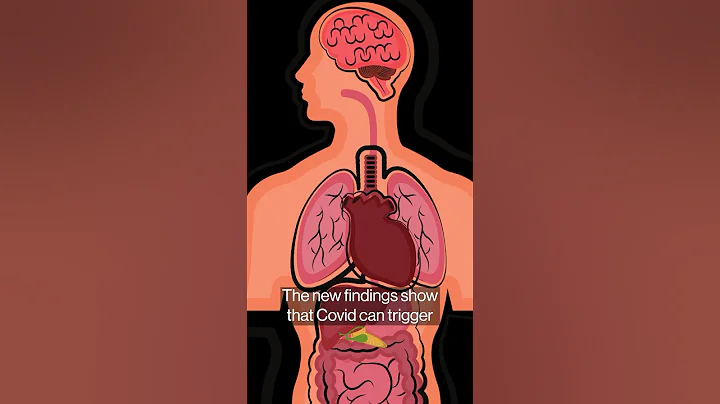 Long Covid Study Links Lingering Virus With Bowel-to-Brain Havoc