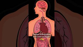 Long Covid Study Links Lingering Virus With Bowel-To-Brain Havoc