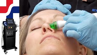 The Most Popular Device for Estheticians - The MediSpa screenshot 1