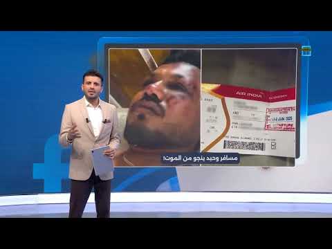 مسافر وحيد ينجو بأعجوبة من حادثة تحطم الطائرة الهندية... كيف؟