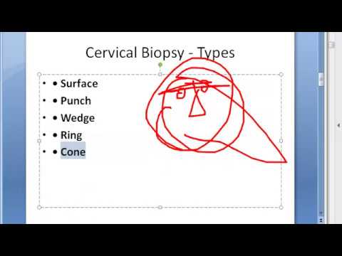 Gynecology Cervical Cervix Biopsy Types Punch Wedge Ring Cone transformation zone Conization