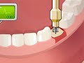 Operate now  dental surgery  dental surgery game