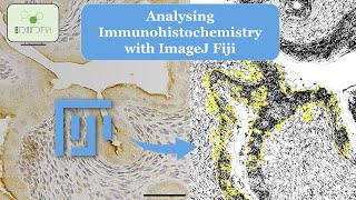 Discover the Secret to Mastering IHC Analysis with ImageJ