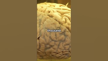 Human Brain Cells on a Chip :The Future  #technews