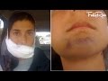 I Got My Wisdom Teeth Removed with NO Anesthesia - A Story of Healing