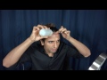 Grow Hair on Receding Hairline Naturally! (dermaroller and essential oils)