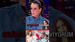 Selülitlerimi Seviyorum - Bestemsu Özdemir #bestemsuözdemir #shorts #hamilelik