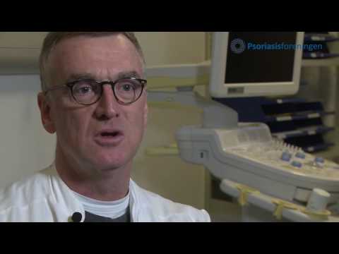 Video: Diagnostik Og Behandling Af Psoriasisgigt