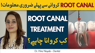 Root Canal Treatment Kya Hai? | THINGS YOU SHOULD KNOW ABOUT ROOT CANAL TREATMENT in Urdu/Hindi