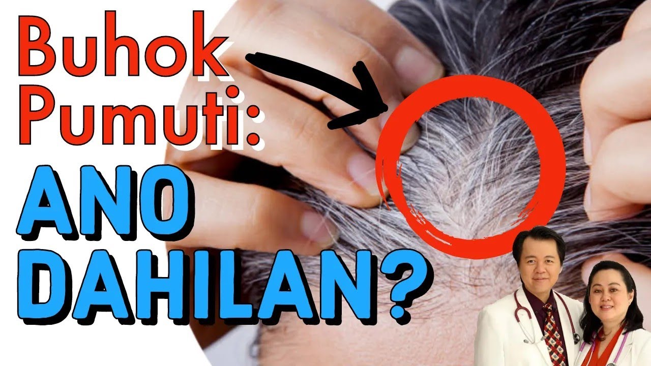 Buhok Pumuti Ano Dahilan Payo Ni Doc Willie Ong 854b YouTube
