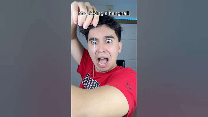 When you Picking a Hangnail😂