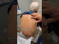 Dermatologist with 50 Years Experience Examines Patient in Clinic π¨π»ββοΈ #dermatology #derm