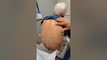 Dermatologist with 50 Years Experience Examines Patient in Clinic 👨🏻‍⚕️ #dermatology  #derm