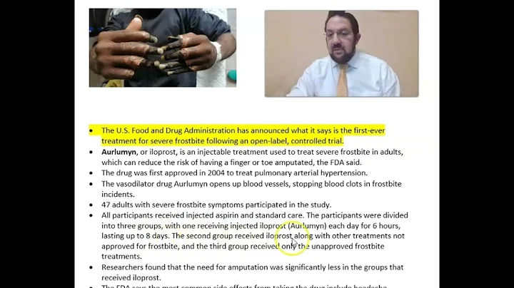 FDA announces approval for first severe frostbite treatment- Aurlumyn