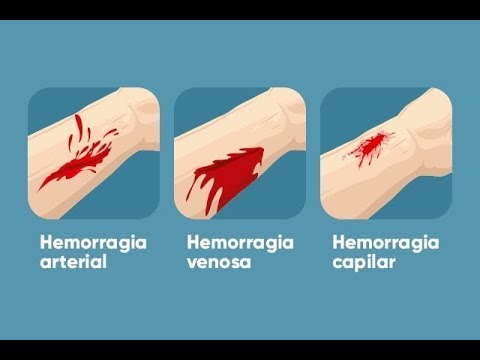 Vídeo: Primeiros Socorros Para Sangramento Pulmonar