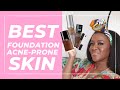 BEST Foundation for Acne Prone Skin 2020 + Pore CLOGGING Ingredients
