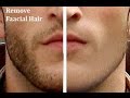 How to remove facial hairs in photoshop