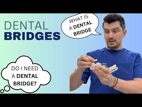 WHAT IS DENTAL BRIDGE? DOES IT LAST LONG? THE PROCCESS OF MAKING DENTAL BRIDGE EXPLAINED.