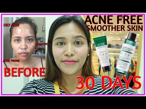 PARA SA MGA ACNE PRONE SKIN ( days miracle toner and cleanser) SOME BY MI