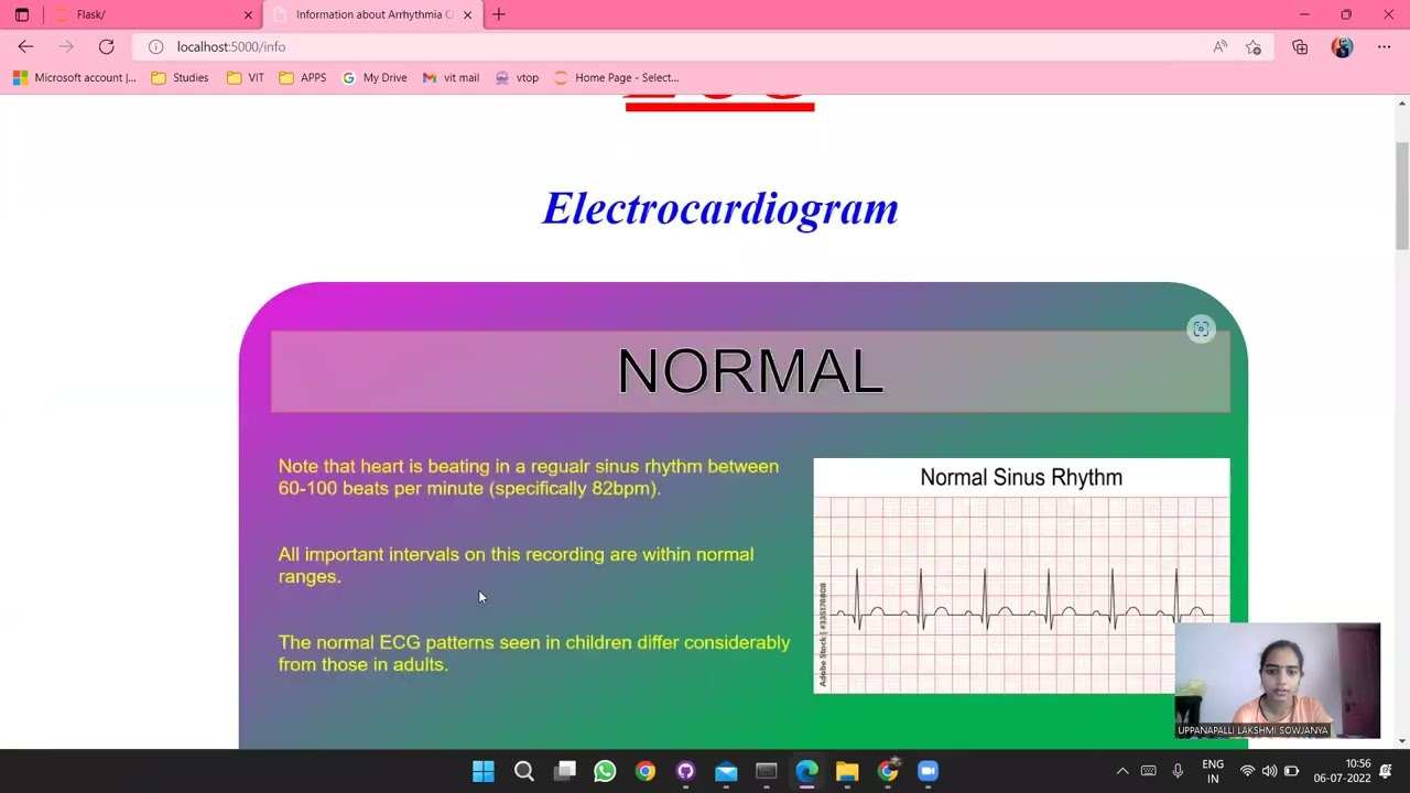 ECG-Arrhythmia-Classification (Image based CNN classification) project.