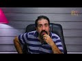 التخلص من خطين الإبتسامة حول الشفاه دكتور محمد دنيا أفضل جراح تجميل في مصر تنسيق قوام شفط دهون التخلص من خطين الإبتسامة حول الشفاه دكتور محمد دنيا أفضل جراح تجميل في مصر تنسيق قوام شفط دهون