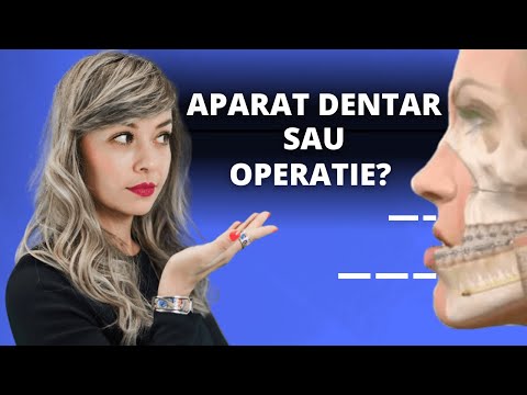 Video: Un expander îți rupe maxilarul?