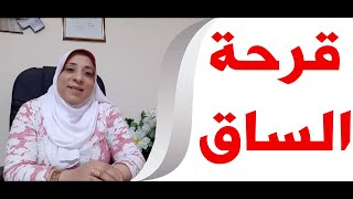 قرحة الساق   مع د.هيام