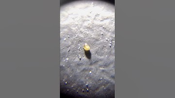 Schurftmijt onder een 60x microscoop.