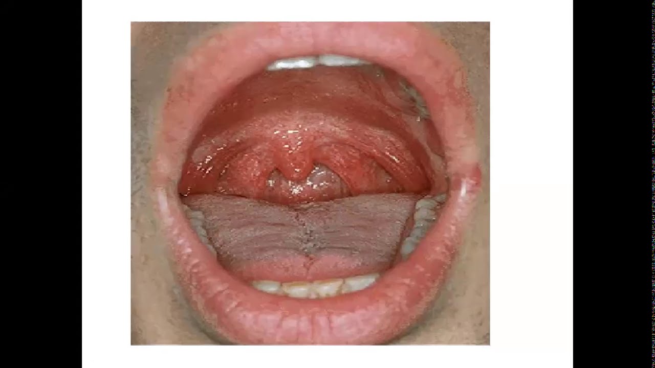 Ular ogiz boshligiga qattiq kiradi Ular ogiz boshligiga qattiq kiradi