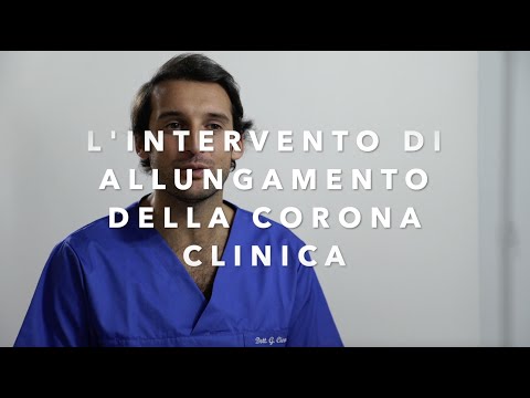 Video: Chi esegue l'allungamento della corona?