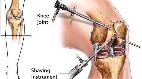 Arthroscopy Wrist CPT code - simplify medical coding