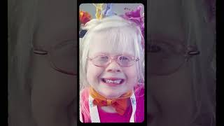 Were the besties with #albinism 🤍 #borndifferent #ytshorts #albinismawareness #visionloss #besties
