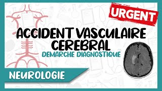 Accident Vasculaire Cérébral Facteurs De Risque, Diagnostic Clinique Paraclinique