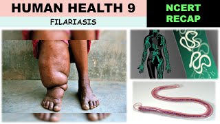 Human health NCERT 9 | Filariasis | Elephantiasis | Wuchereria bancrofti | Culex | W malayi