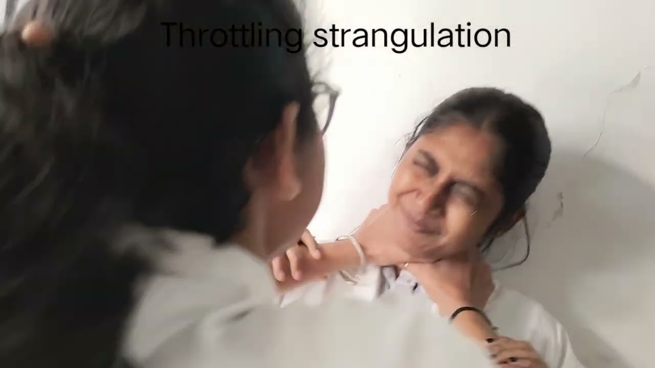 Strangulation of forensic medicine and toxicology 