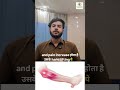 elbow pain' 💪 fix your pain with uss call us at 9654300103.#acupunctureneedles #physiotherapy