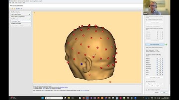 Co-registration of EEG data with individual MRI