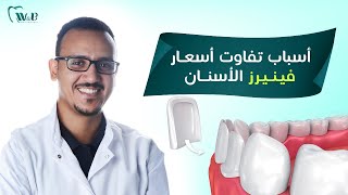 اسعار فينير الاسنان في مصر 2021 (اسباب تفاوت الأسعار) | د/أحمد السيد