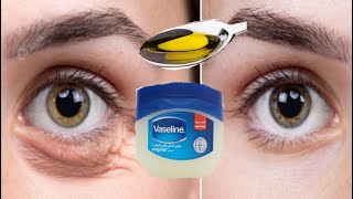 In 3 days completely remove under eye bags | dark circles, wrinkles | puffy eyelids