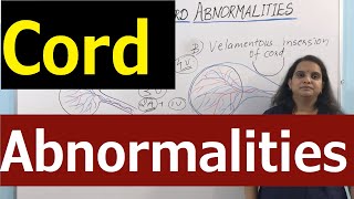 Umbilical Cord Abnormalities 🚺 Morphological variation of Cord 🚺 Nursing Lecture