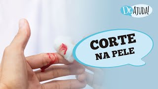 CORTE NA PELE COMO TRATAR GRAVIDADE E PONTOS DE ATENCAO
