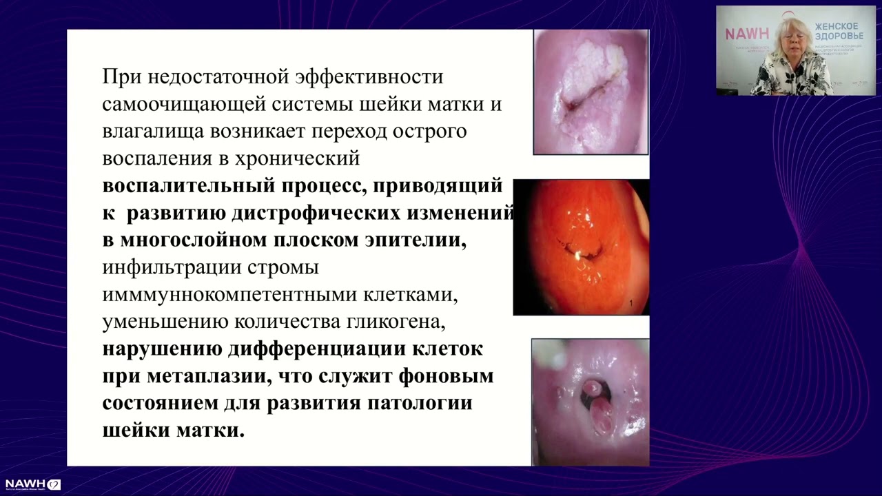 Научно практическая конференция «Кольпоскопия.  Заболевания шейки матки»